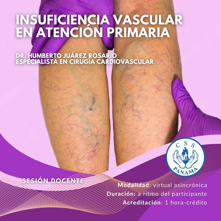 Insuficiencia vascular en atención primaria