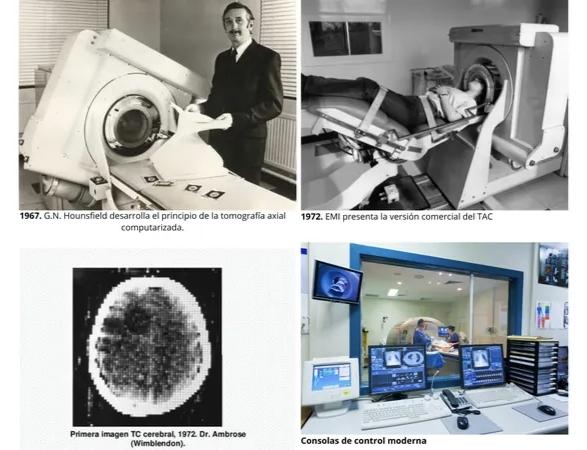 Optimizacion y protección radiológica: Protocolos de tomografía cerebral de trauma y cumplimiento de medidas de seguridad del POE en estudios Gastrointestinales