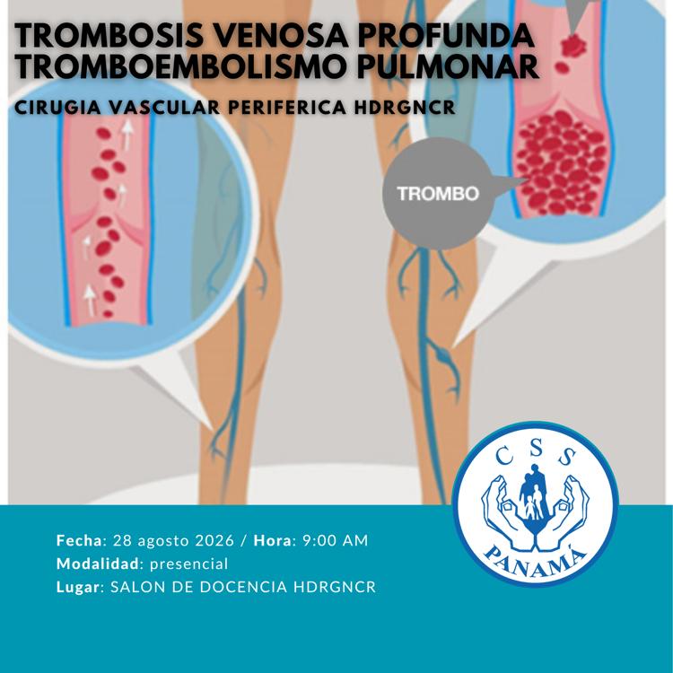 TROMBOSIS VENOSA PROFUNDA Y TROMBOEMBOLISMO PULMONAR