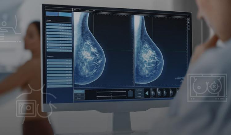 MAMOGRAFIA COMO HERRAMIENTA DE DETECCION TEMPRANA-PDG